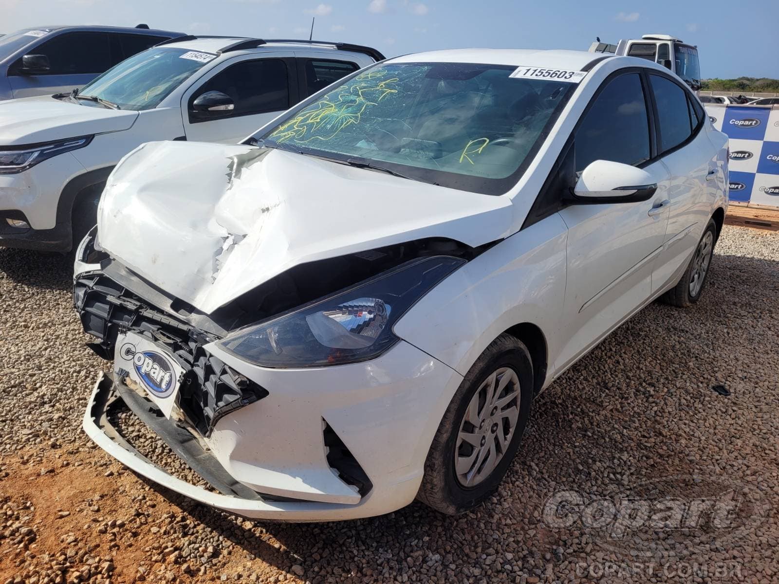 Hyundai Hb20s 2020 — foto 2