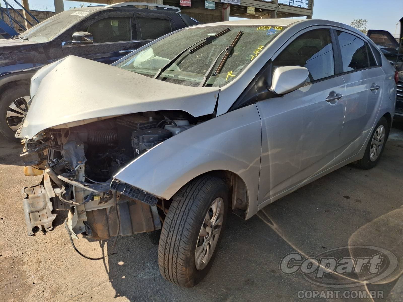 Hyundai Hb20s 2015 — foto 2
