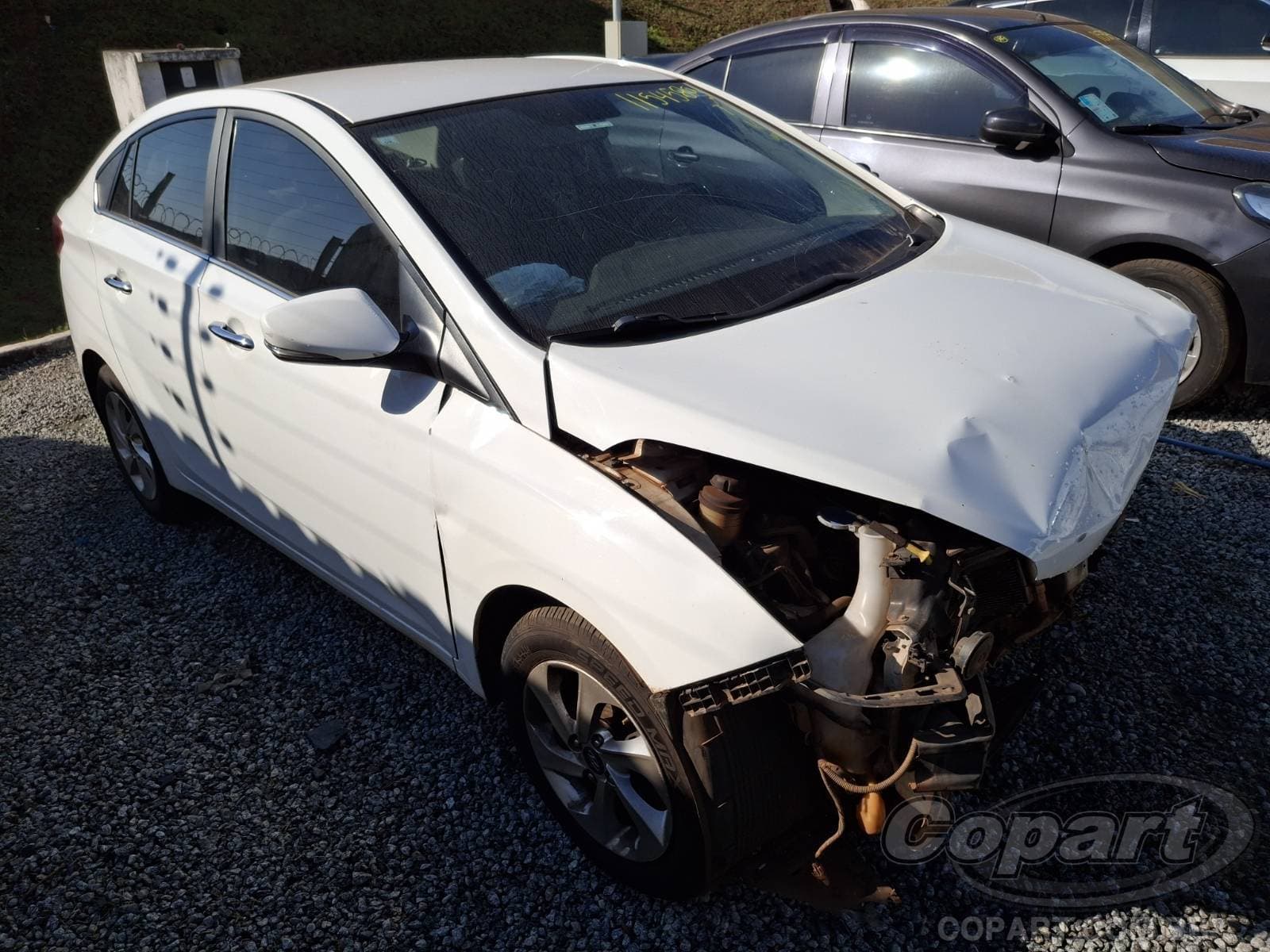 Hyundai Hb20s 2016 — foto 1