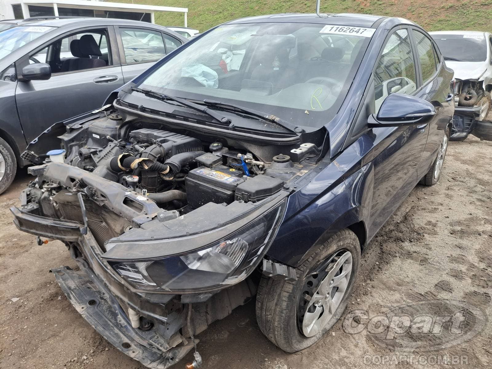 Hyundai Hb20s 2024 — foto 2