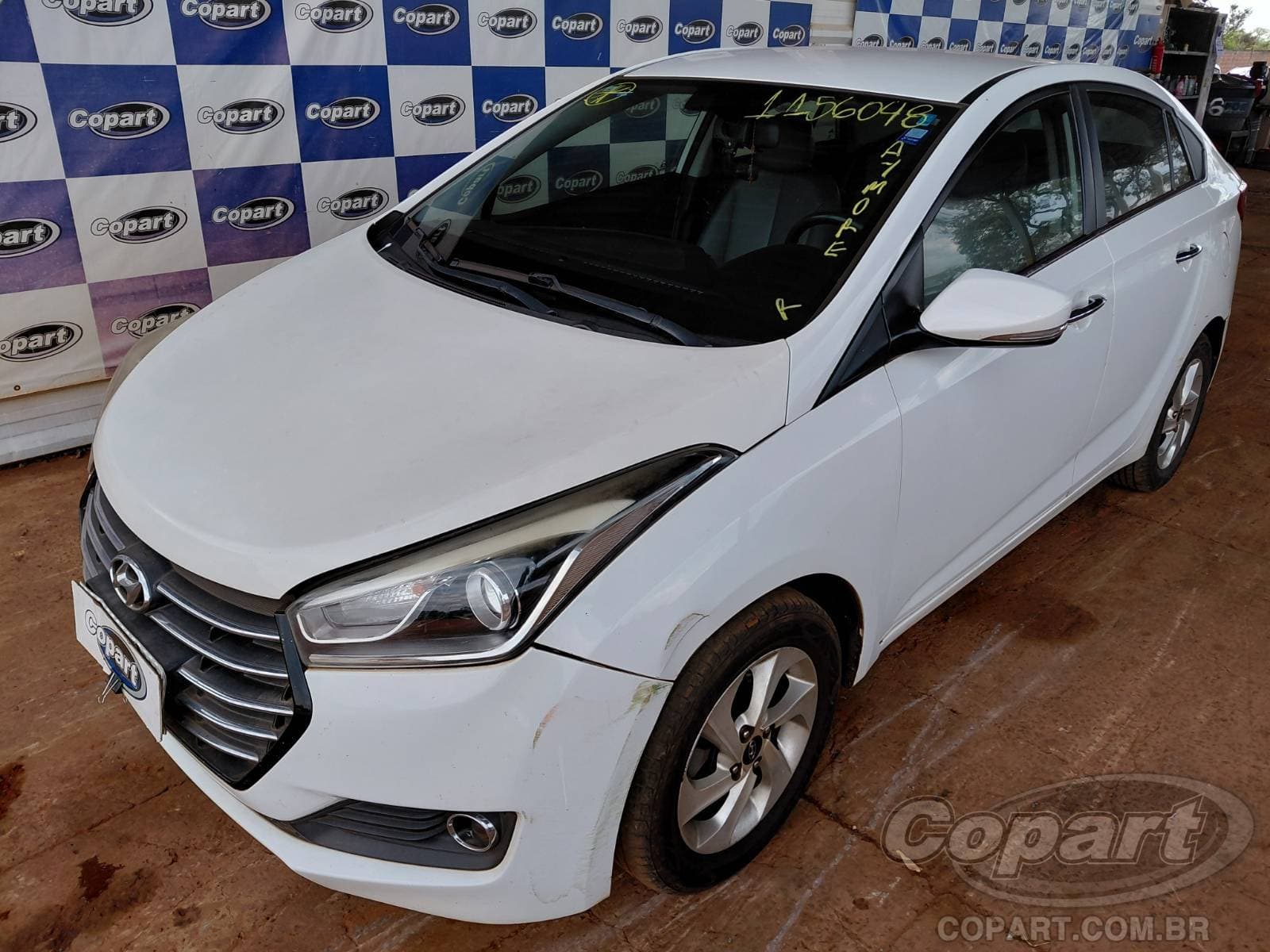 Hyundai Hb20s 2018 — foto 2