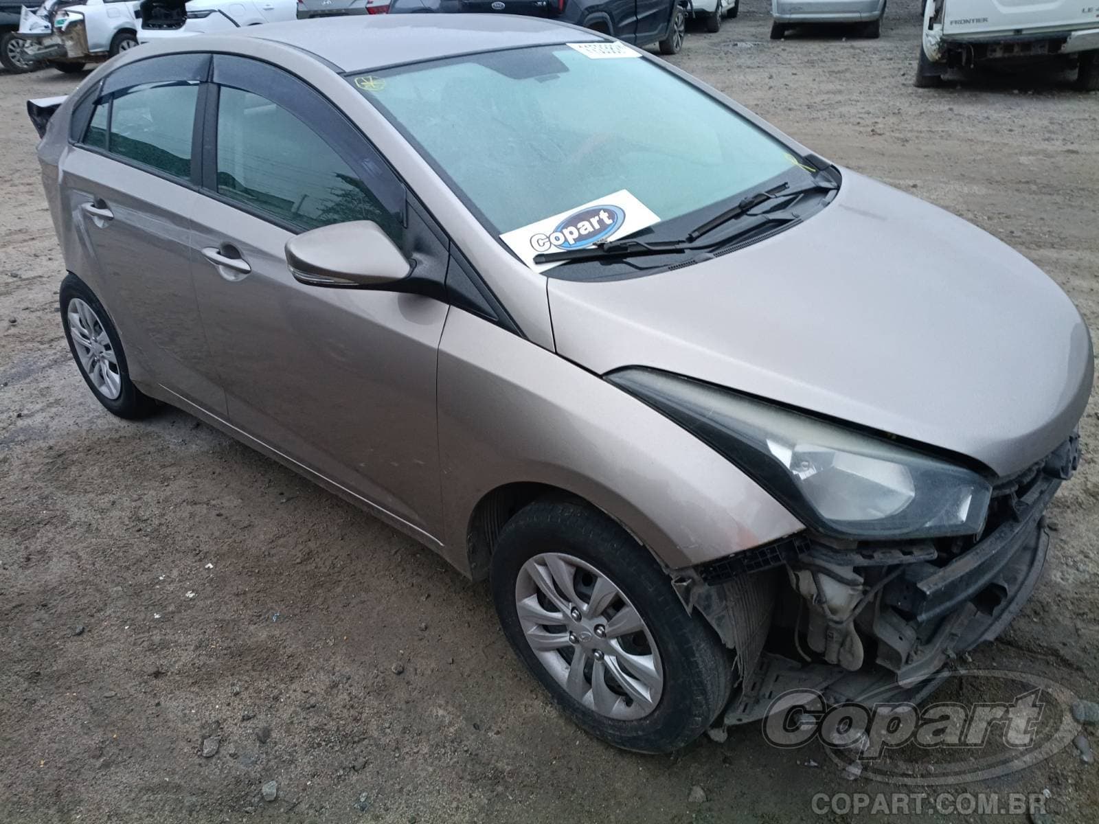 Hyundai Hb20s 2016 — foto 1