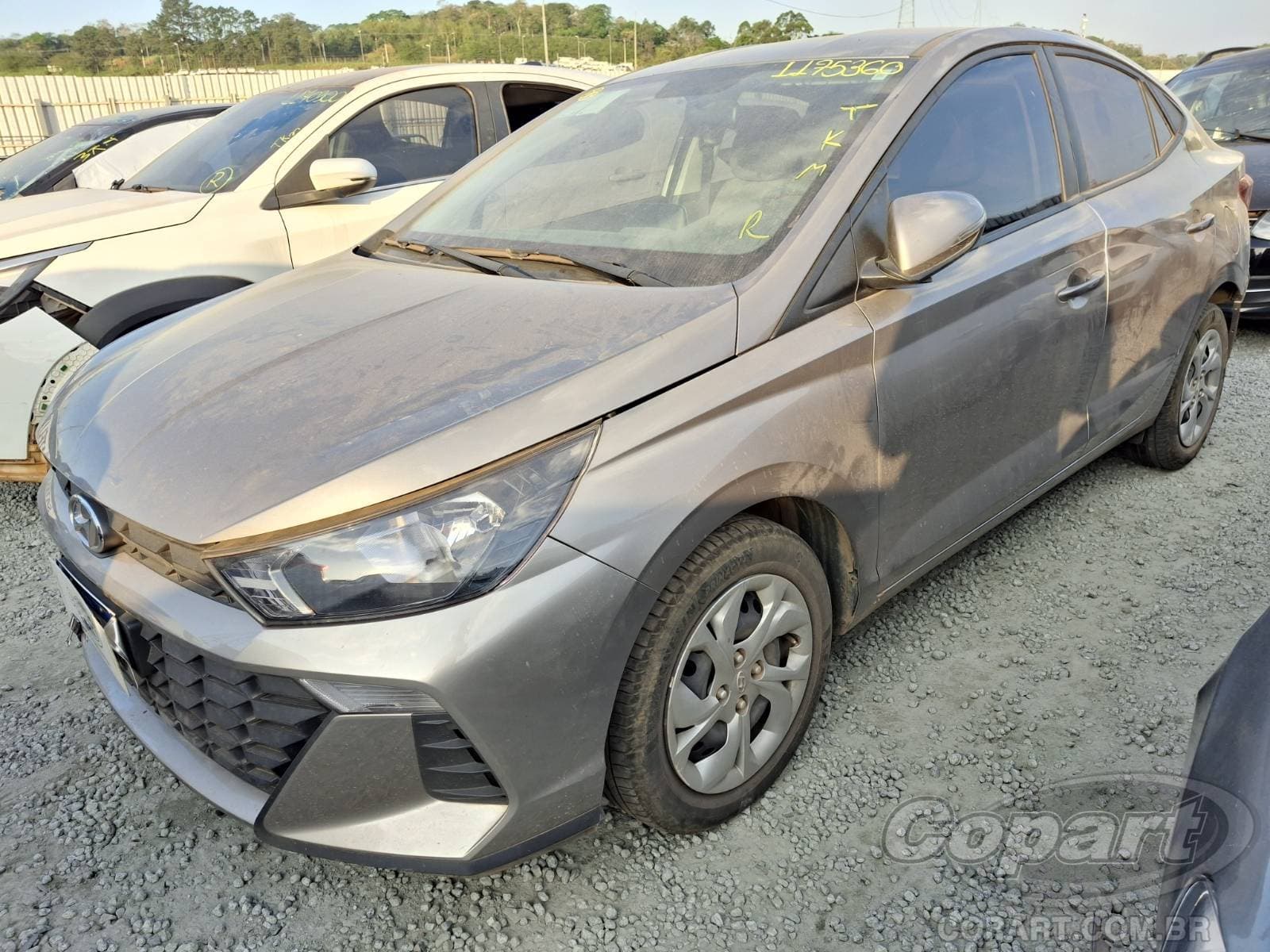 Hyundai Hb20s 2025 — foto 2