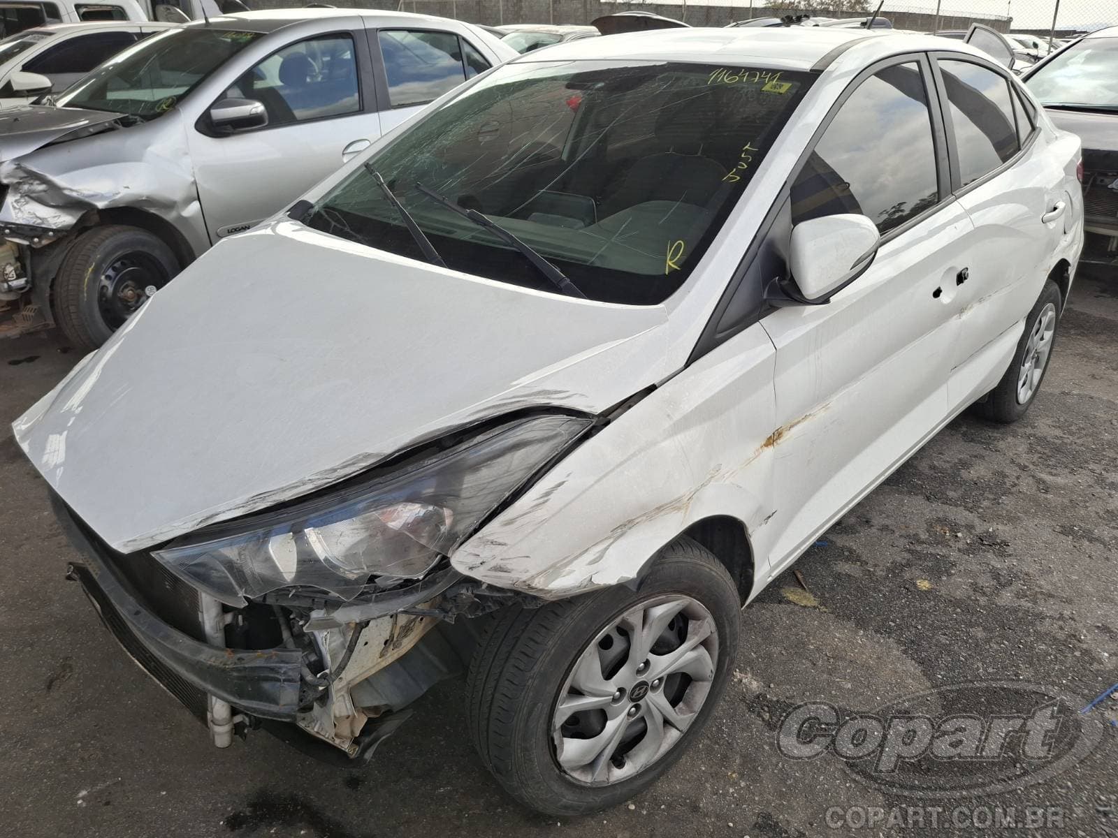Hyundai Hb20s 2022 — foto 2