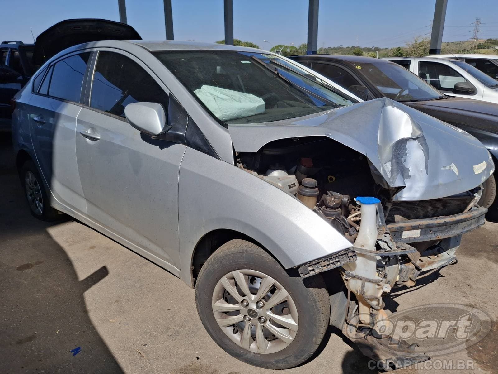 Hyundai Hb20s 2015 — foto 1