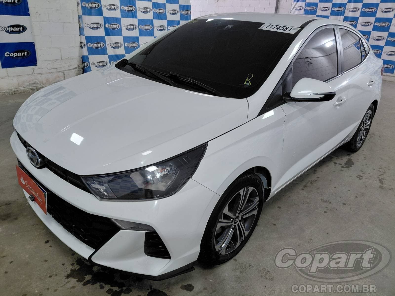 Hyundai Hb20s 2024 — foto 2