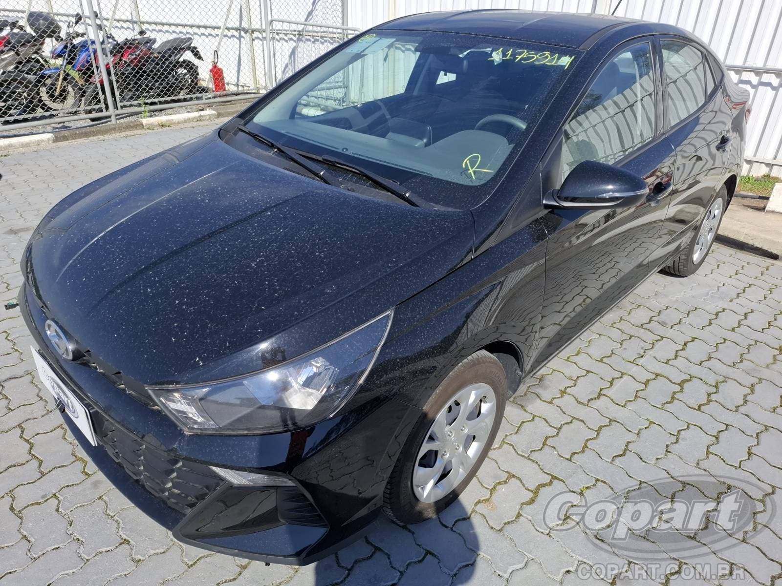 Hyundai Hb20s 2025 — foto 2